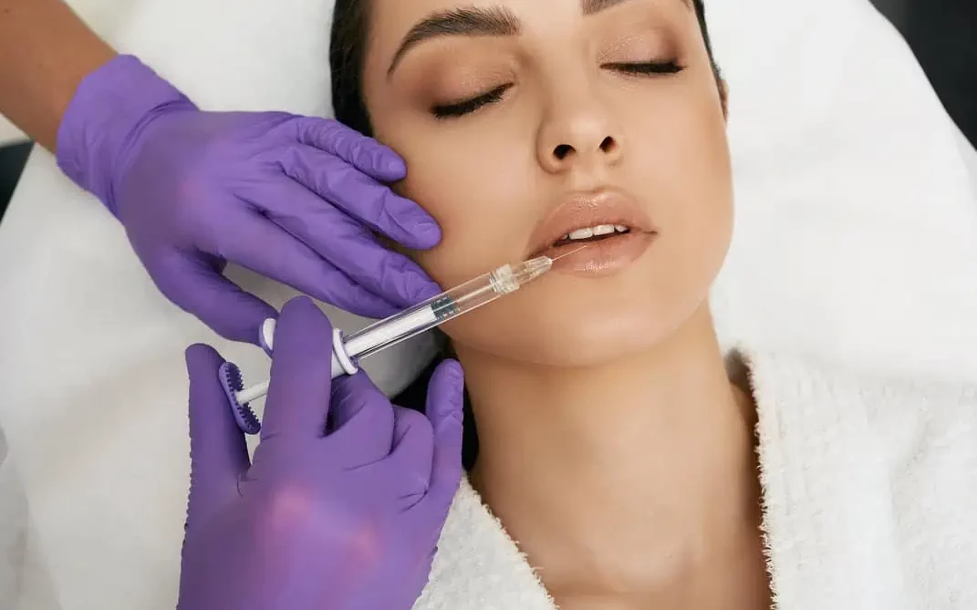 lip fillers by Cahaba Aesthetics in libertyville